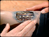 ''The Deadly Missiles''
Inge's hand (top) on Bionic leg